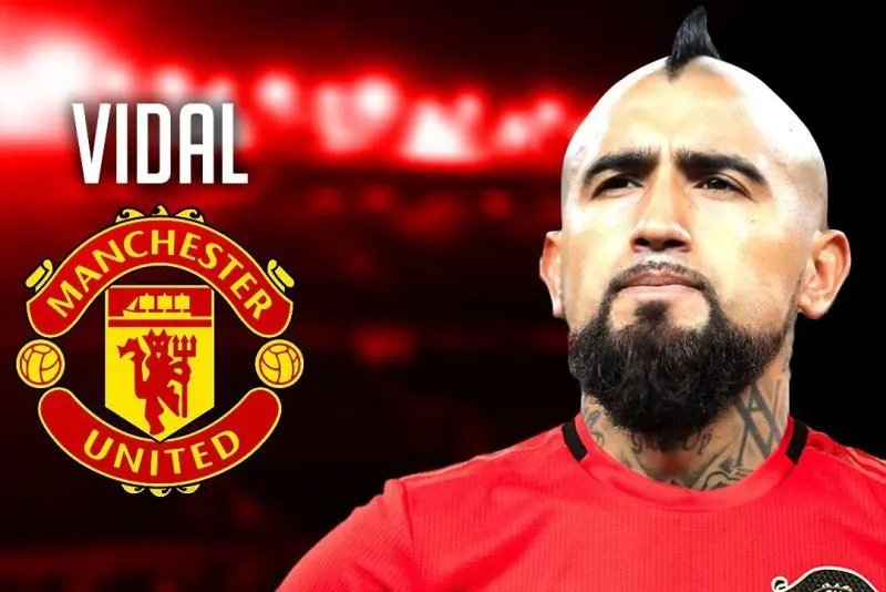 ảnh chế Arturo Vidal 22