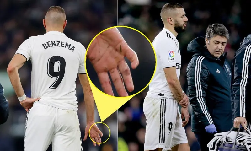 ảnh chế Karim Benzema 1