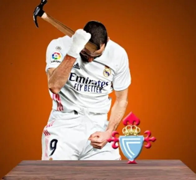 ảnh chế Karim Benzema 13