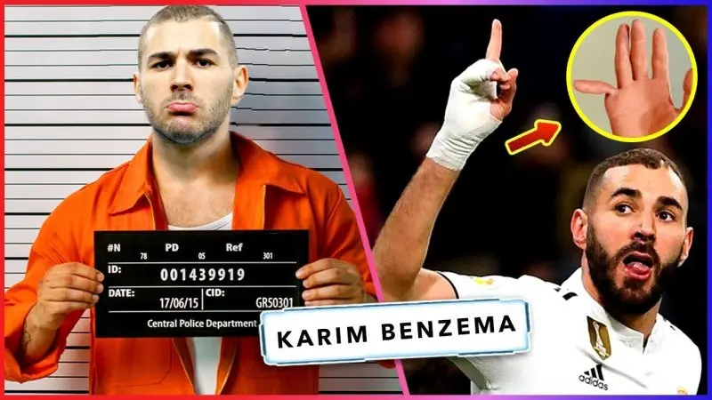 ảnh chế Karim Benzema 44