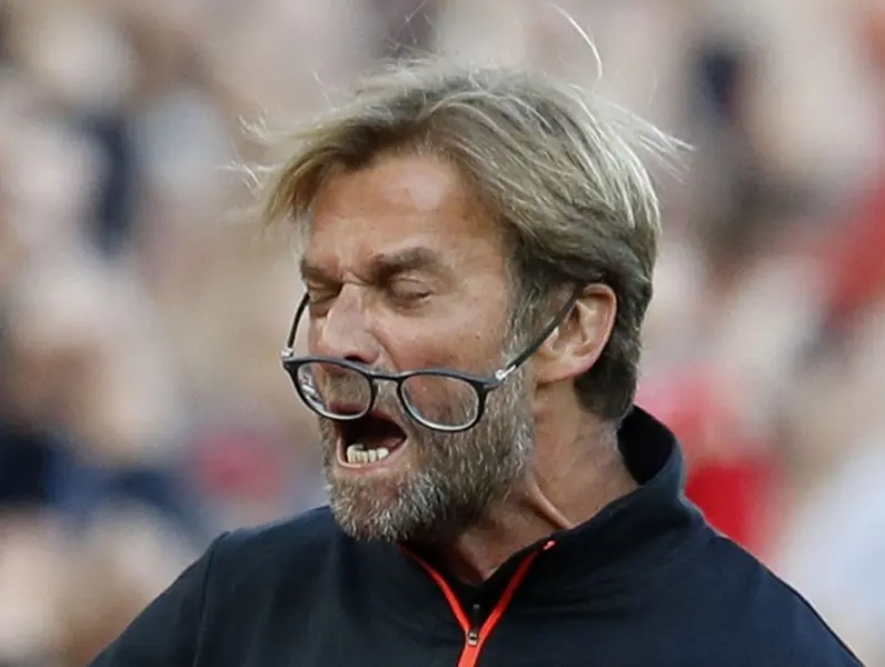 ảnh chế Jürgen Klopp 39