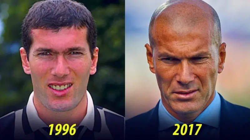 ảnh chế Zinedine Zidane 2