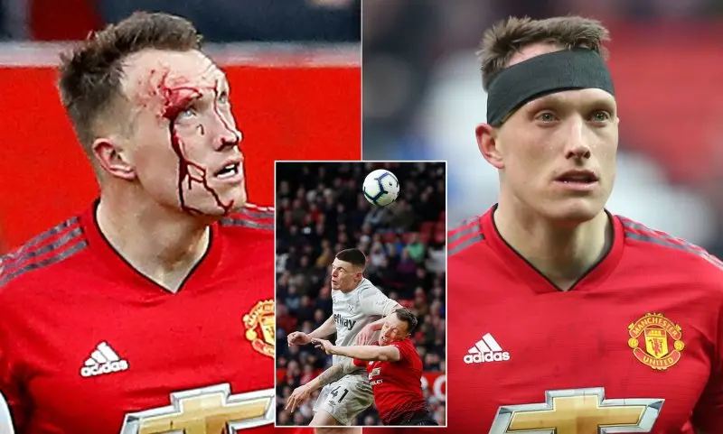 ảnh chế Phil Jones 21