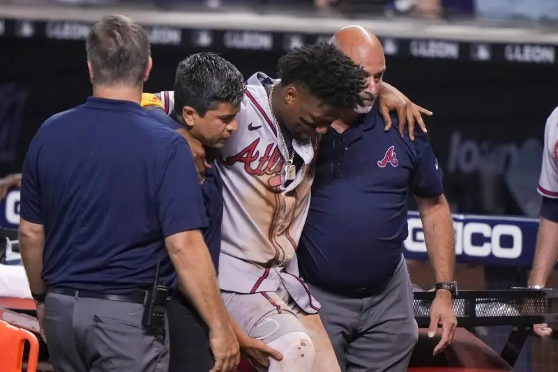 Top 95+ ảnh Ronald Acuña Jr, niềm tự hào của Atlanta Braves 29