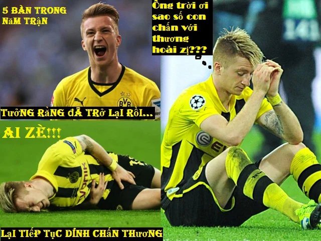 ảnh chế Marco Reus 19