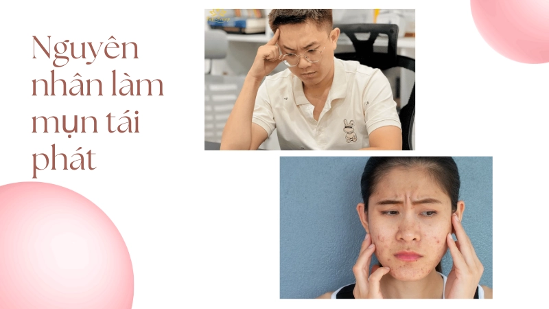 Căng thẳng kéo dài là nguyên nhân mụn tái phát dai dẳng