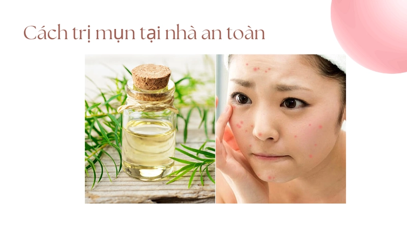 Sử dụng tinh dầu tràm trà trong cách trị mụn tại nhà