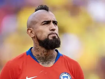 Bộ sưu tập ảnh chế Arturo Vidal ngộ nghĩnh và hài hước nhất